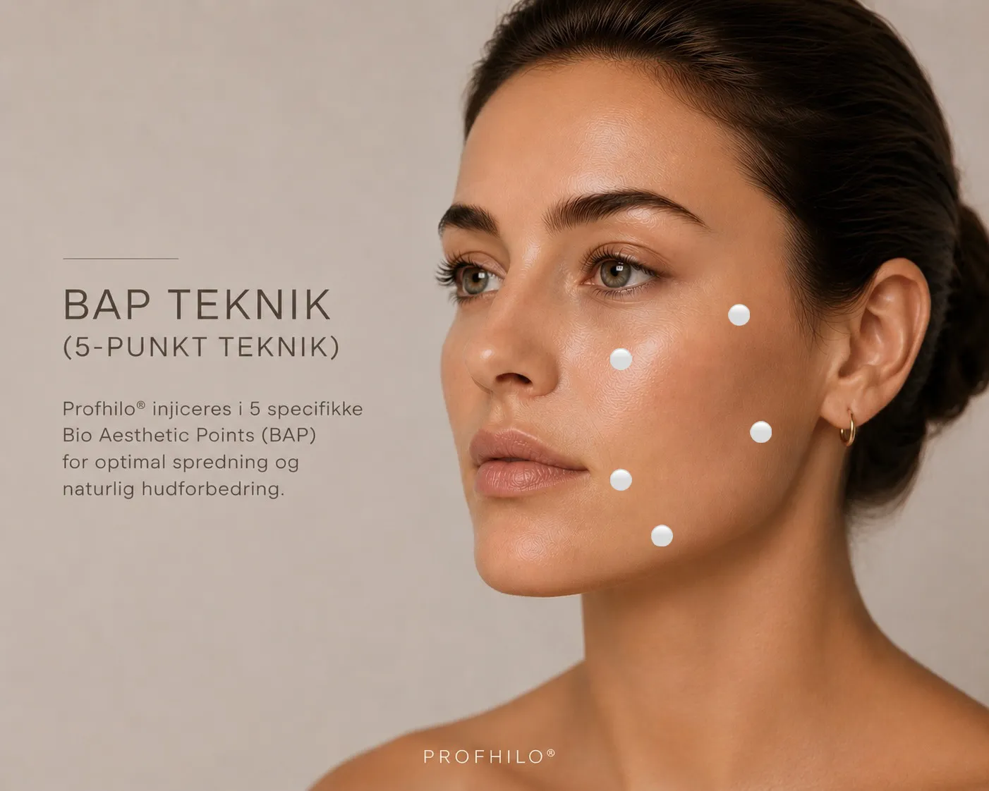 Profhilo-behandling med BAP-teknik i ansigtet